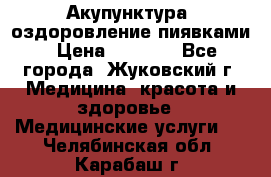 Акупунктура, оздоровление пиявками › Цена ­ 3 000 - Все города, Жуковский г. Медицина, красота и здоровье » Медицинские услуги   . Челябинская обл.,Карабаш г.